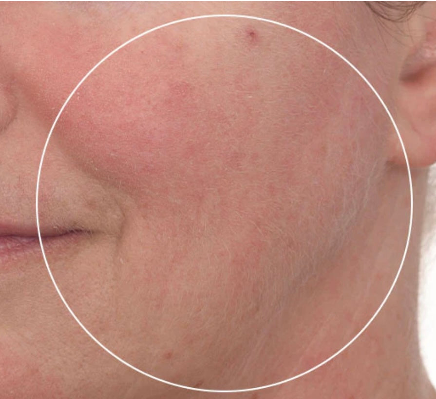 Facial Treatments