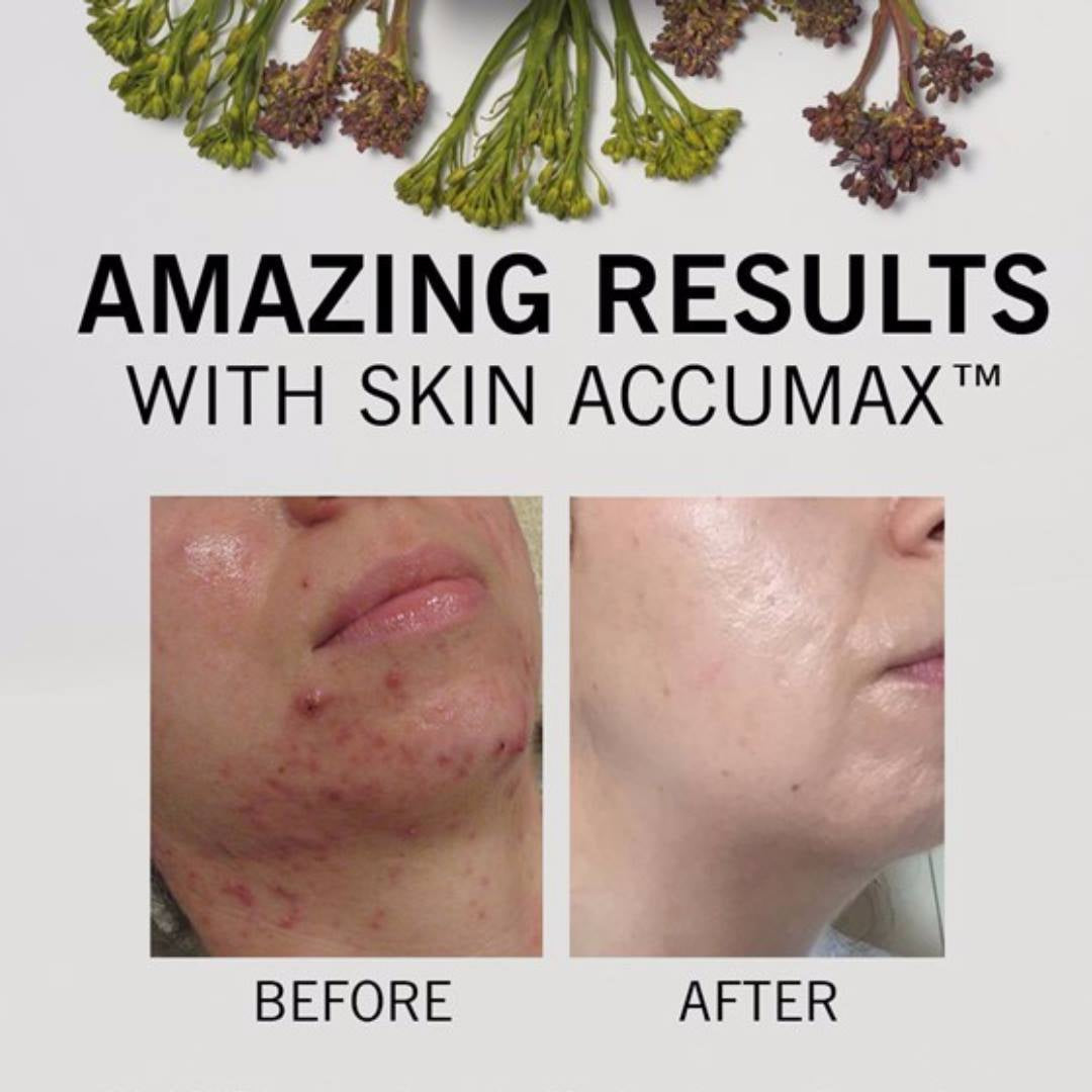 Advanced Nutrition Program - Skin Accumax™ - 60 Capsules